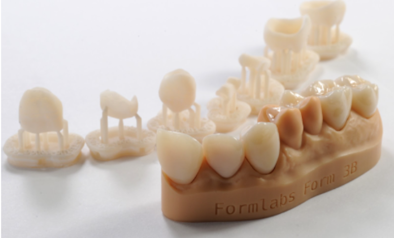 Mit Permanent Crown 3D-gedruckte Teile und Beispiel für schattierte Teile