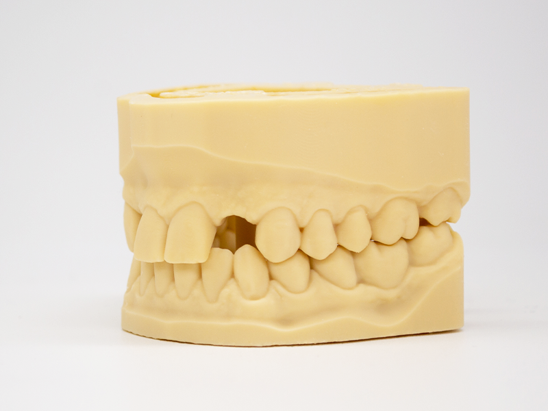 Modelo dental impreso en 3D con la resina DMD-21 Sand