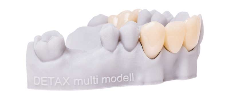 Impressions réalisées avec la résine dentaire 3D Freeprint Crown.