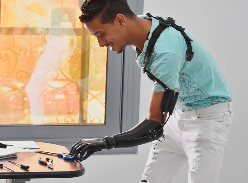 Forward AM PLA filament is successfully used in 3D printing prosthetics.