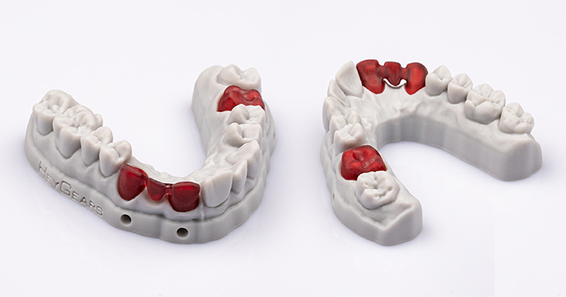 Aplicações da resina dental Cast UV 3.0. Fonte: HeyGears