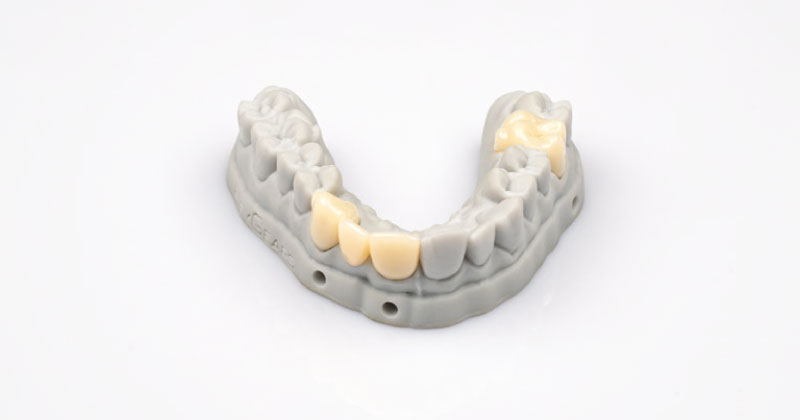 Aplicações da resina Crowntec (LT Crown UV) da HeyGears