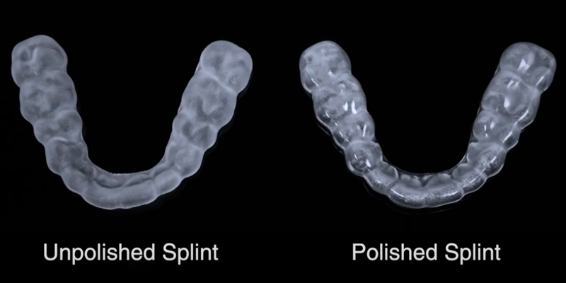 A splint before and after polishing with the KeyPolish kit