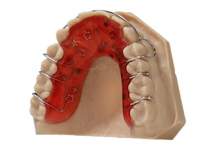Peça impressa com a resina de separação. Fonte: Liqcreate
