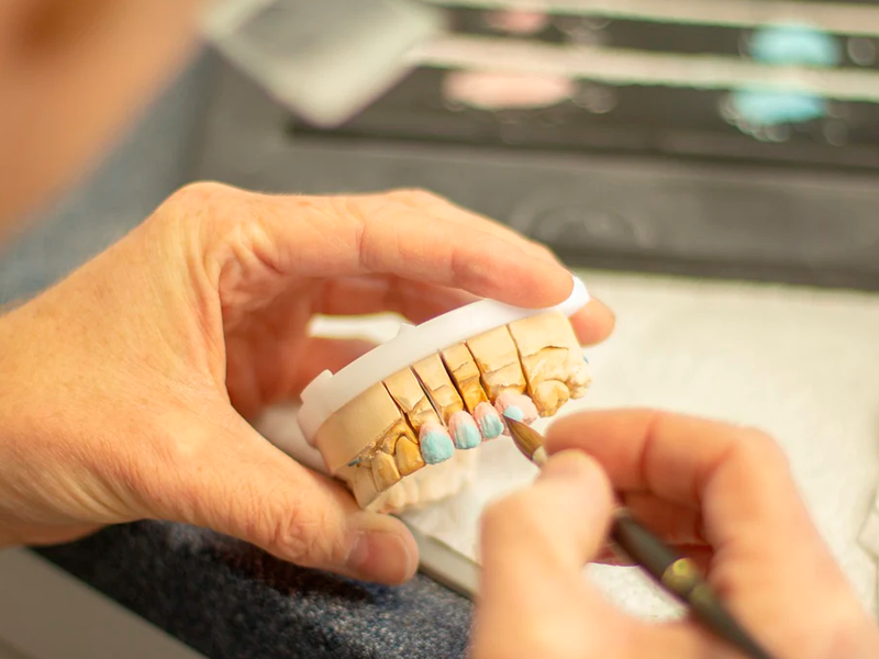 Modelo dental impreso en 3D con la impresora 3D de resina Sonic 4K 2022