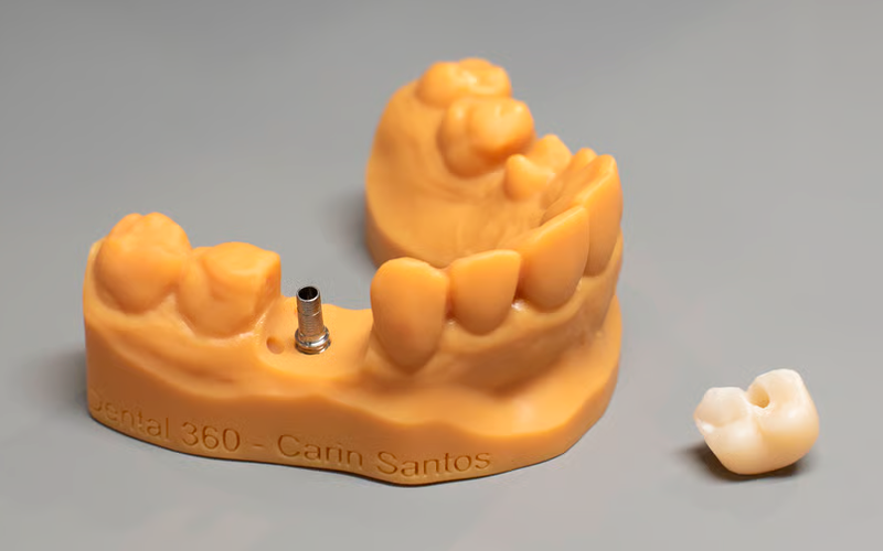 Model+ resin offers high opacity and outstanding detail reproduction for dental models, delivering excellent visual and mechanical precision. Ideal for dentistry and orthodontic applications.