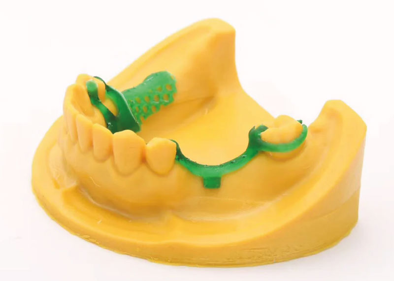 Impresión realizada con la resina dental C01 verde transparente