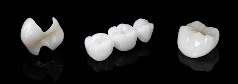Various applications printed with 3D dental resin Sculpture