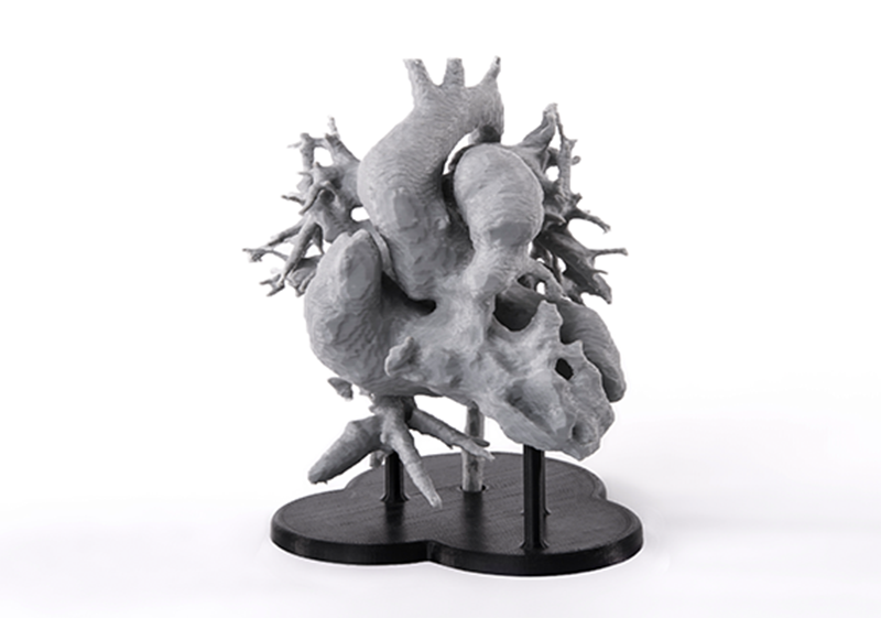Modelo de coração real impresso com Z-PLA