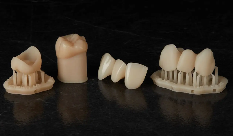 Couronnes permanentes et provisoires imprimées en 3D avec la résine VarseoSmile TriniQ