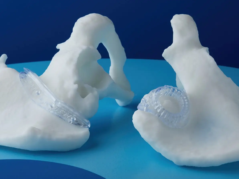 Surgical guides printed with BioMed Durable resin on a pelvic bone printed with BioMed White resin