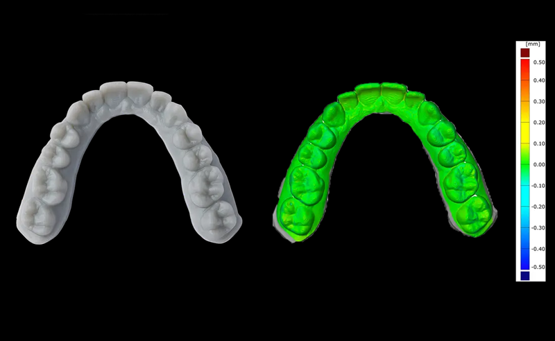 L'alta precisione finale del modello garantisce una perfetta vestibilità e soddisfazione del paziente