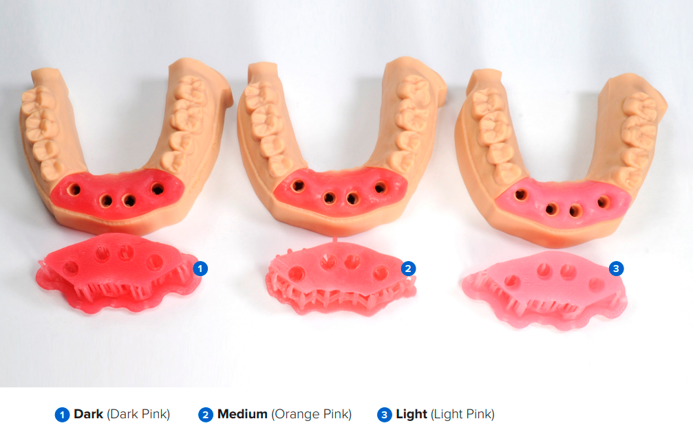 Tonalità personalizzata con la resina Soft Tissue.