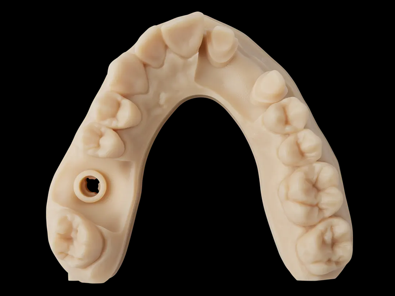 Ein präzises diagnostisches Zahnmodell, das mit dem Precision Model Harz im 3D-Druckverfahren hergestellt wurde