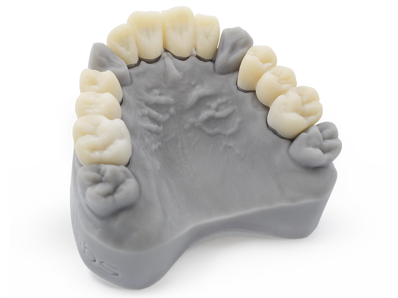 Ein Zahnmodell aus dem Dental Model Light Grey Harz