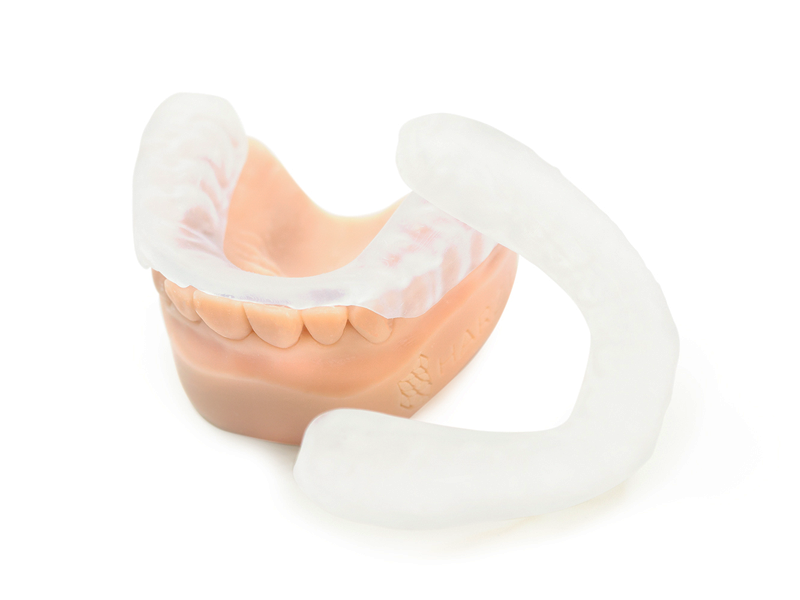 Dental guards made of HARZ Labs Dental Clear PRO Resin