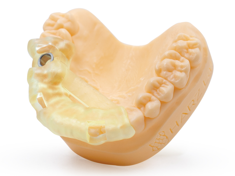 Dental model made of HARZ Labs Dental Yellow Clear Pro Resin