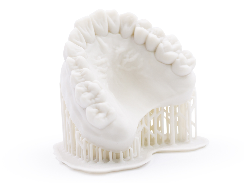 Mit Dental Model Bone gedrucktes Zahnmodell